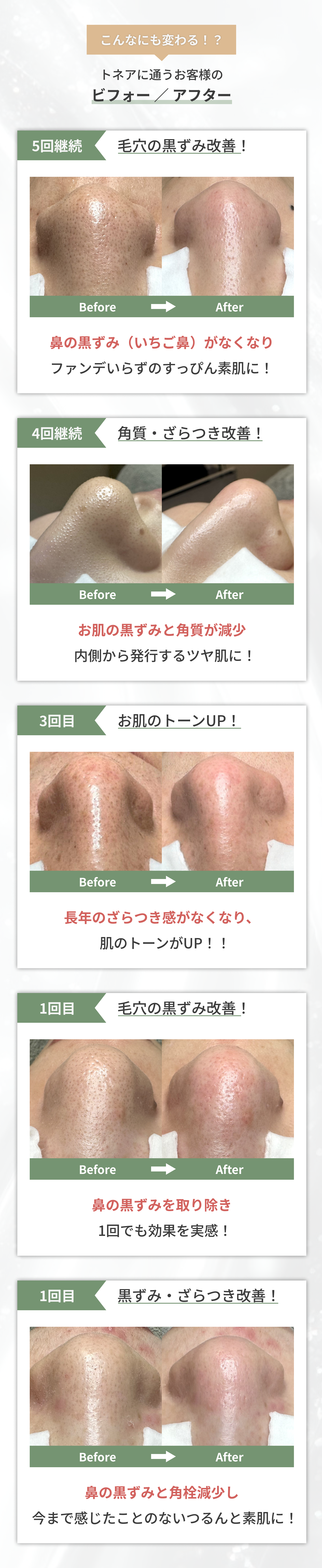 before-after画像